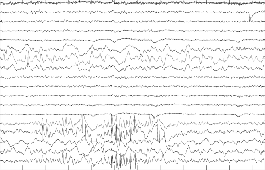 Raw EEG signal